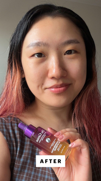 Allure commerce editor Sarah Han after applying the Dr. Groot Scalp Barrier Boost Oil in Serum